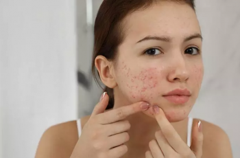 How Skin Inflammation Starts and How You Can Treat It